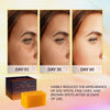 Valitic Kojic Acid Turmeric Soap Bars